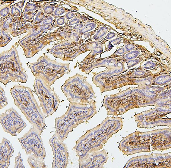 SQSTM1/p62 Mouse Monoclonal Antibody