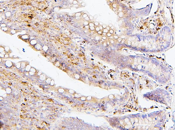 SQSTM1/p62 Mouse Monoclonal Antibody