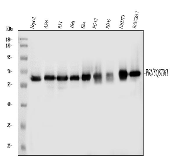 SQSTM1/p62 Mouse Monoclonal Antibody