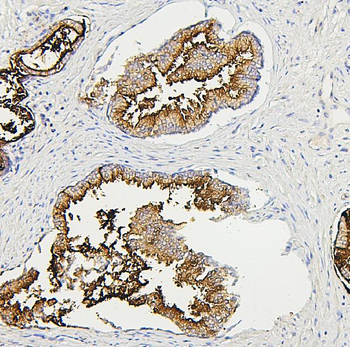 RAB27A Mouse Monoclonal Antibody
