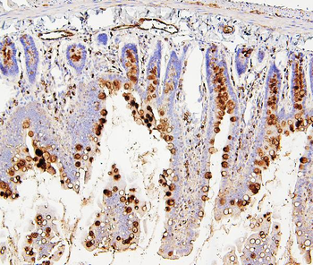 RAB27A Mouse Monoclonal Antibody