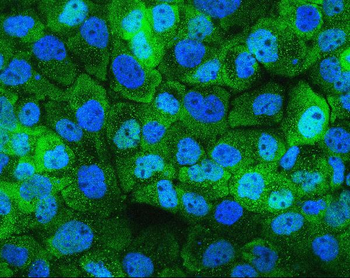Hsp105/HSPH1 Mouse Monoclonal Antibody
