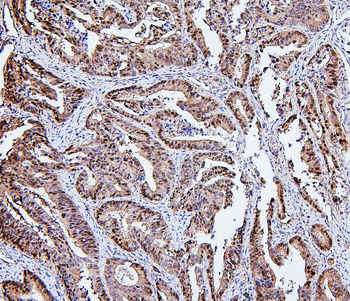 Hsp105/HSPH1 Mouse Monoclonal Antibody