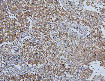 Hsp105/HSPH1 Mouse Monoclonal Antibody