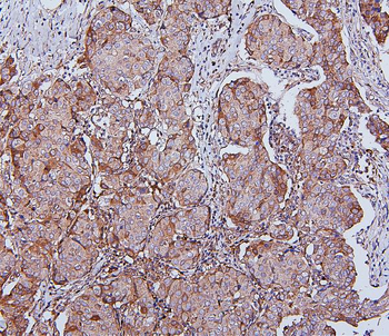 Hsp105/HSPH1 Mouse Monoclonal Antibody