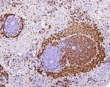 PAX5 Mouse Monoclonal Antibody