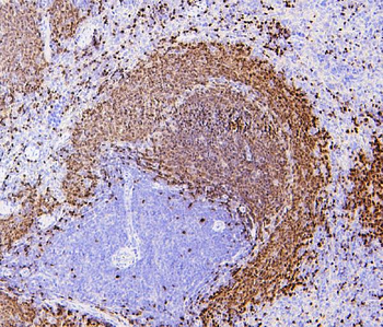 PAX5 Mouse Monoclonal Antibody
