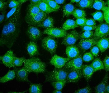 COPE Mouse Monoclonal Antibody
