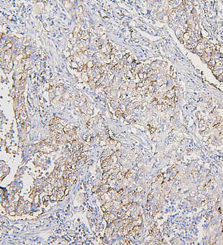 COPE Mouse Monoclonal Antibody