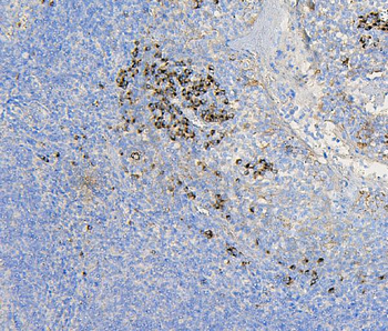 COPE Mouse Monoclonal Antibody