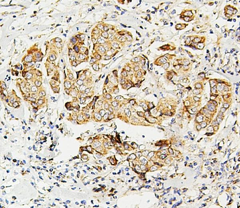 SDHB Mouse Monoclonal Antibody