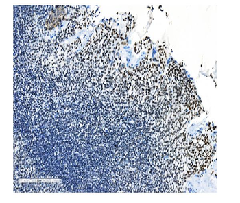 NRF1 Mouse Monoclonal Antibody