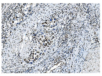 NRF1 Mouse Monoclonal Antibody