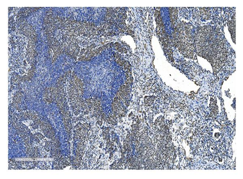NRF1 Mouse Monoclonal Antibody