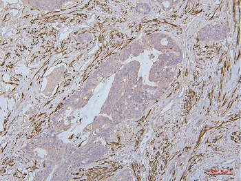 Desmin Mouse Monoclonal Antibody