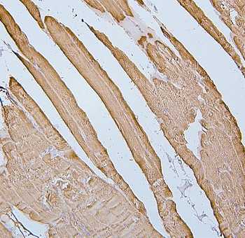 Desmin Mouse Monoclonal Antibody
