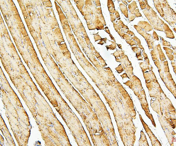 Desmin Mouse Monoclonal Antibody