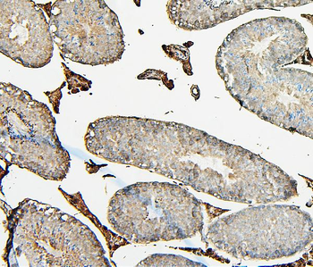COMT Mouse Monoclonal Antibody