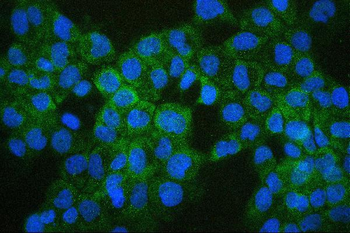 COMT Mouse Monoclonal Antibody