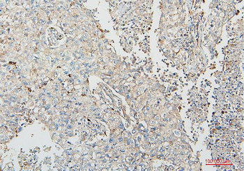COMT Mouse Monoclonal Antibody