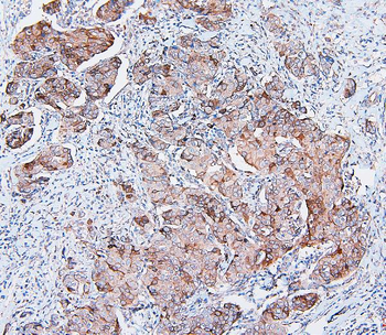 COMT Mouse Monoclonal Antibody