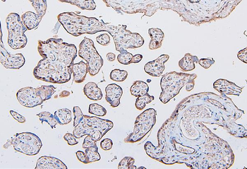 COMT Mouse Monoclonal Antibody