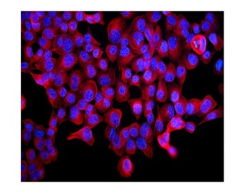 ABCB5 Rabbit Polyclonal Antibody