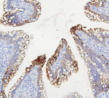ABCB5 Rabbit Polyclonal Antibody