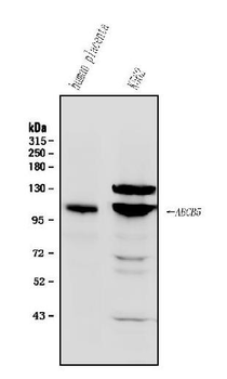 ABCB5 Rabbit Polyclonal Antibody