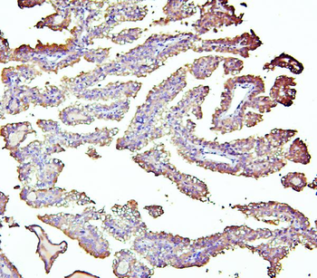 Retinal dehydrogenase 1 ALDH1A1 Rabbit Polyclonal Antibody
