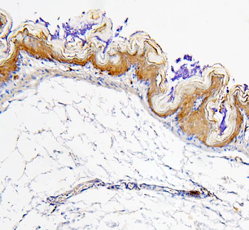 Retinal dehydrogenase 1 ALDH1A1 Rabbit Polyclonal Antibody
