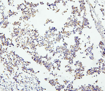 DCC Rabbit Polyclonal Antibody