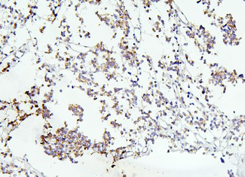 DCC Rabbit Polyclonal Antibody