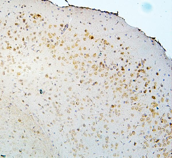 DCC Rabbit Polyclonal Antibody