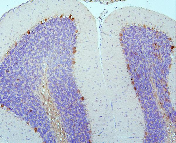 DCC Rabbit Polyclonal Antibody