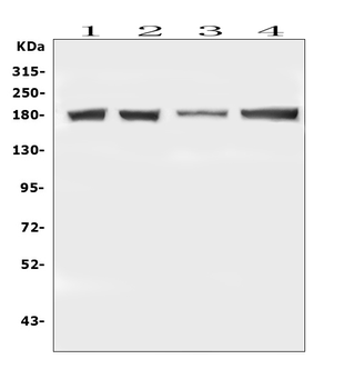 DCC Rabbit Polyclonal Antibody