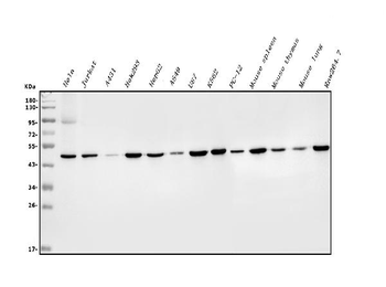 EIF4A1/2/3 Rabbit Polyclonal Antibody
