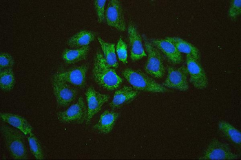 EIF4A1/2/3 Rabbit Polyclonal Antibody
