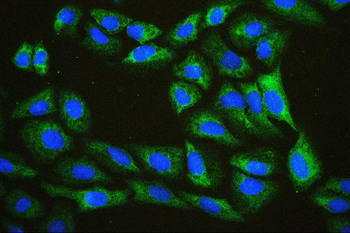 EIF4A1/2/3 Rabbit Polyclonal Antibody