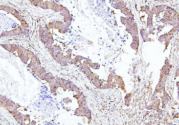EIF4A1/2/3 Rabbit Polyclonal Antibody