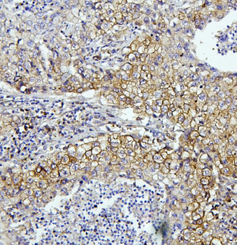 EIF4A1/2/3 Rabbit Polyclonal Antibody