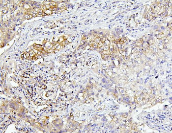 EIF4A1/2/3 Rabbit Polyclonal Antibody