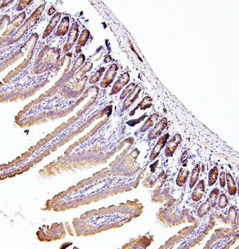 EIF4A1/2/3 Rabbit Polyclonal Antibody