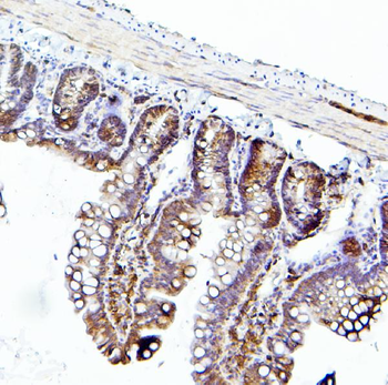 EIF4A1/2/3 Rabbit Polyclonal Antibody