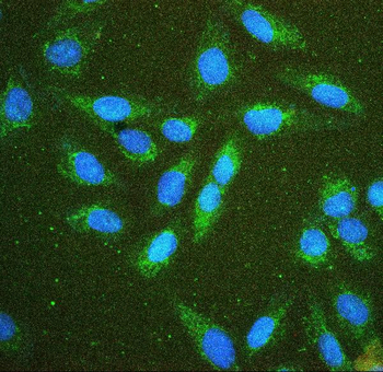 Hexokinase 1/HK1 Rabbit Polyclonal Antibody