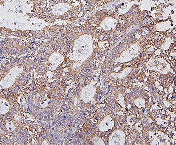 Hexokinase 1/HK1 Rabbit Polyclonal Antibody