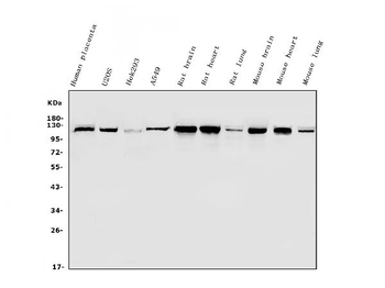Hexokinase 1/HK1 Rabbit Polyclonal Antibody