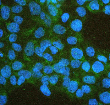 IFNAR2 Rabbit Polyclonal Antibody