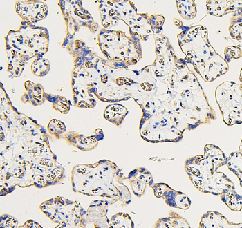 IFNAR2 Rabbit Polyclonal Antibody