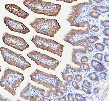 IFNAR2 Rabbit Polyclonal Antibody